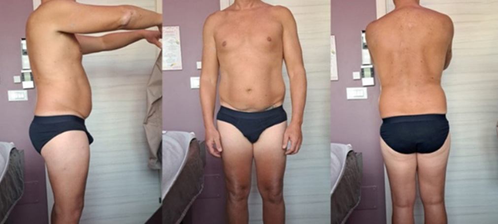 ADIPOUT PRIMA E DOPO UOMO_Tagliato_1b